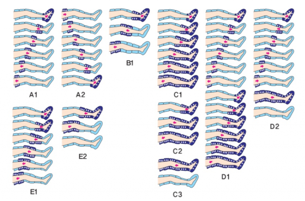 Einstellungen Lymphdraiange Gerät Ganzkörperanzug Lymphdrainage-12Kammer-Ganzkörperanzug-Funktion