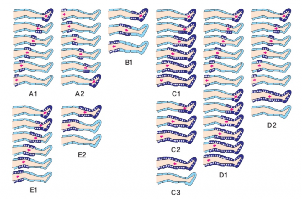 Lymphdrainage-12Kammer-Ganzkörperanzug-Funktion